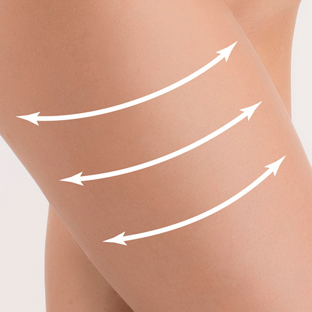 Lipo & Striae Strong Body Cream